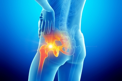 Orthopaedic
